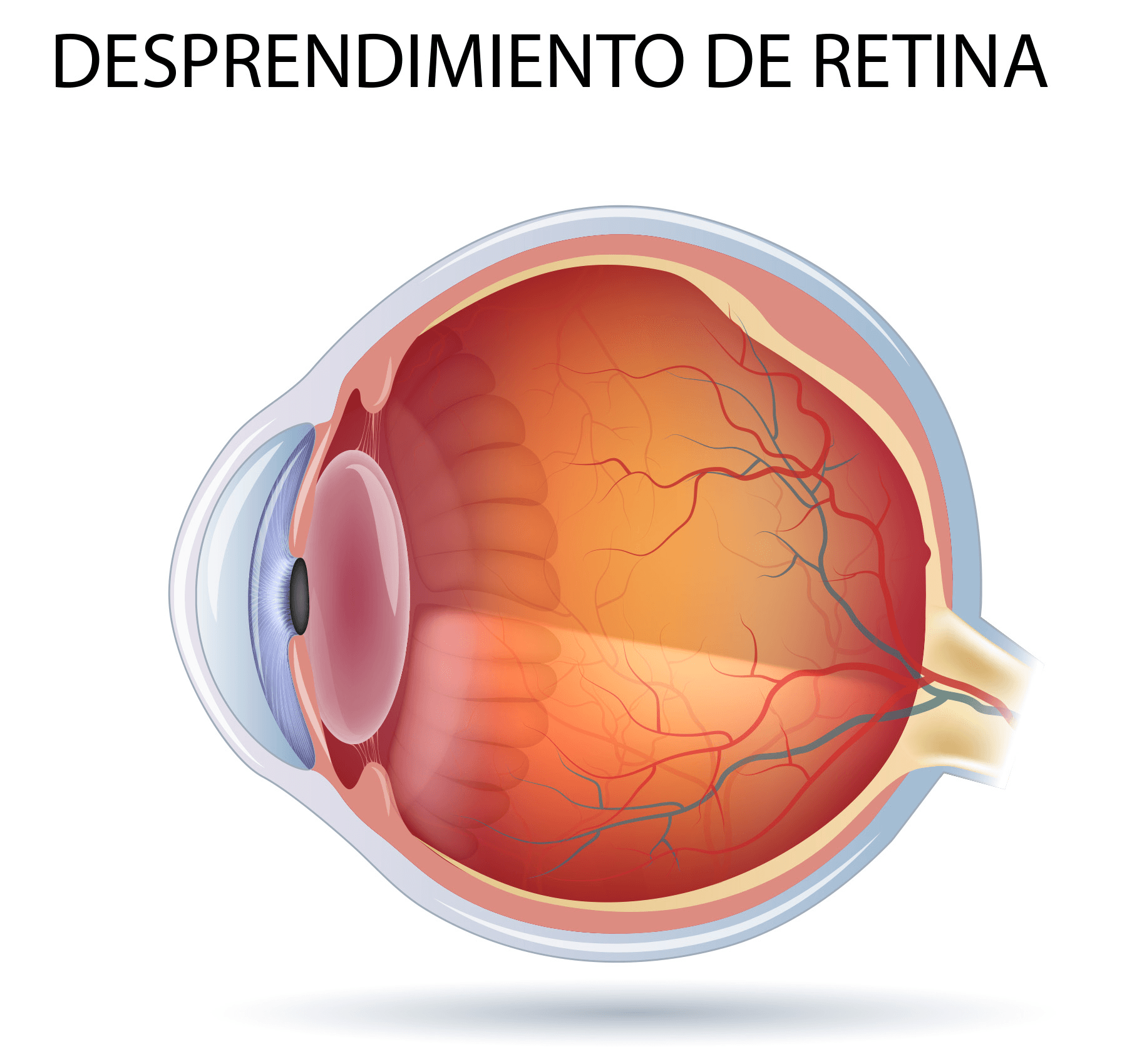 Cirugía de Retina en Buenos Aires