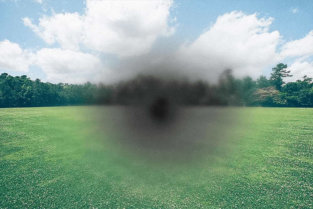 Degeneración Macular: diagnóstico y tratamiento en Buenos Aires